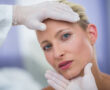 Image showcasing before and after results of Effective Treatment for Sagging Facial Skin.