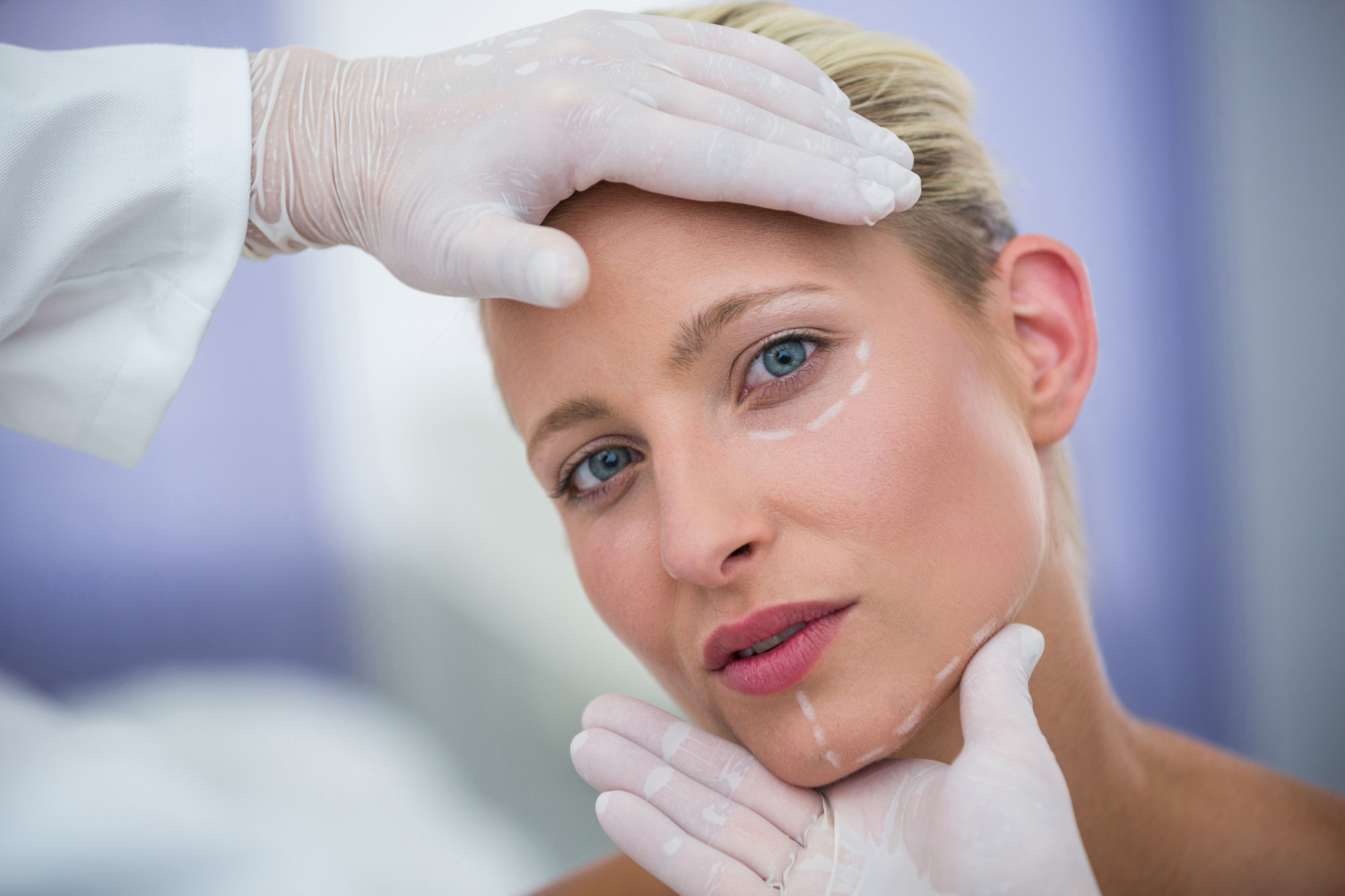 Image showcasing before and after results of Effective Treatment for Sagging Facial Skin.